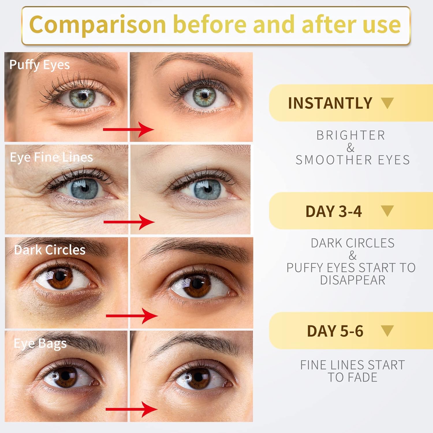 24K Gold Under Eye Patches - 60 Pack for Puffy Eyes, Dark Circles, Bags & Wrinkles with Collagen & Hyaluronic Acid - Eye Care Pads for Daily Skincare (Gold) - Image 3