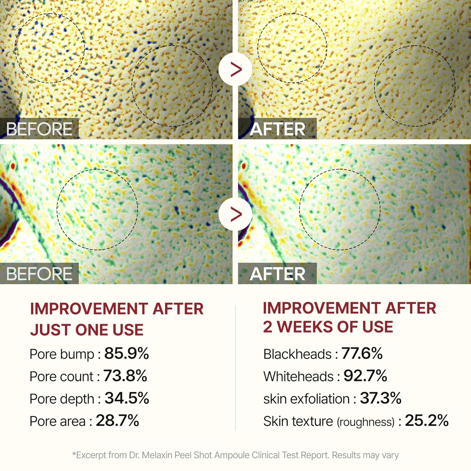 Dr.Melaxin Peel Shot Glow Black Rice Peeling Ampoule 80ml, Dead Skin Remover Gentle Exfoliating with Rice Water Extract, AHA BHA, Niacinamide, Daily Skin Texture, All Skin Types, Korean Skincare - Image 6